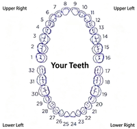 Grillz personnalisés en argent sterling 925 avec moissanite VVS, plaqué rhodium, sertissage pavé, coupe huit cœurs et flèches, bijoux dentaires personnalisés