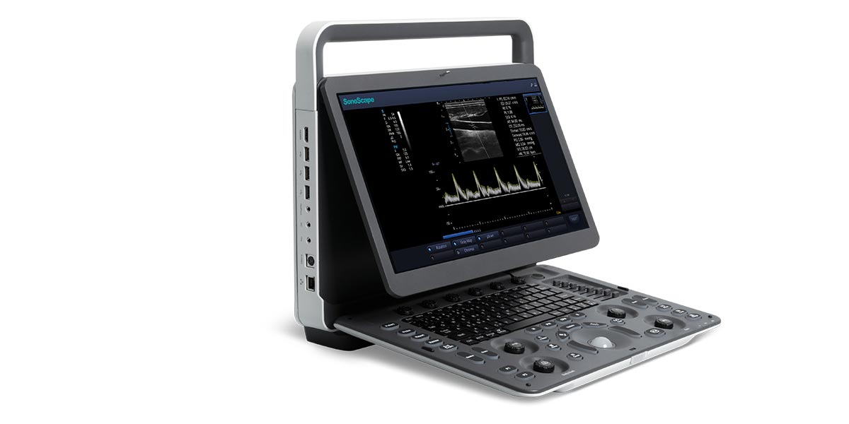 Sonoscape E1Vet Portable BW Veterinary Ultrasound - 15.6" Screen, 500GB HDD