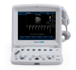 Appareil d'échographie Doppler couleur portable Edan U50, instruments d'échographie médicale pour le diagnostic clinique humain - Product Image 2