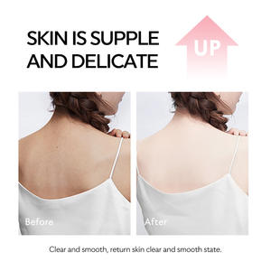 Sudáfrica Hot Rose Toner Surface Body Care Hidratante Iluminador Precio al por mayor 275ml - Product Image 3