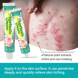 Ungüento Tópico Wangtailin para la Dermatitis Fúngica y <span class=keywords><strong>el</strong></span> Eccema, Anti-picazón, Bacteriostático, 20g - Product Image 5