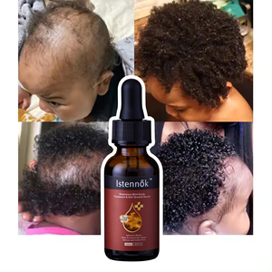 <span class=keywords><strong>Tonico</strong></span> <span class=keywords><strong>naturale</strong></span> per la crescita dei capelli per la cura del cuoio capelluto 30ml di estratti di erbe cinesi di alta qualità olio di cocco allo zenzero biologico di menta piperita - Product Image 6