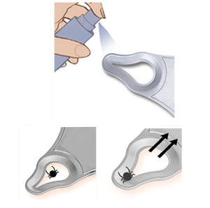 Extracteur de puces pour animaux de compagnie; Outil d'élimination des puces indolore; Outil d'élimination des tiques pour animaux de compagnie. - Product Image 6