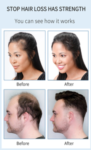 Loción tónica orgánica China para el cabello, suero de esencia de aceite de romero, laca nutritiva para el cabello que ayuda a crecer el cabello Calvo rápidamente - Product Image 6