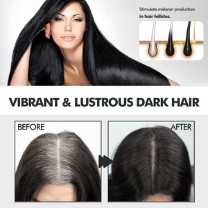 Vente en gros de <span class=keywords><strong>spray</strong></span> pour <span class=keywords><strong>cheveux</strong></span> <span class=keywords><strong>spray</strong></span> nourrissant pour le cuir chevelu favorisant la croissance couvrant les <span class=keywords><strong>cheveux</strong></span> <span class=keywords><strong>blancs</strong></span> <span class=keywords><strong>spray</strong></span> assombrissant pour <span class=keywords><strong>cheveux</strong></span> noirs naturels - Product Image 5