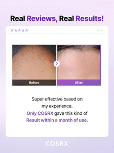 [สำหรับ Afreeca เท่านั้น][COSRX] AHA BHA Clarifying Treatment Toner 150 มล. สำหรับผลัดเซลล์ผิวและทำความสะอาดผิวเพื่อปรับสภาพผิวให้ดีขึ้น - Product Image 2