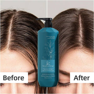 Après-shampoing capillaire biologique à la lavande, marque privée, <span class=keywords><strong>meilleur</strong></span> après-shampoing capillaire biologique à la lavande, anti-chute, fortifiant - Product Image 6