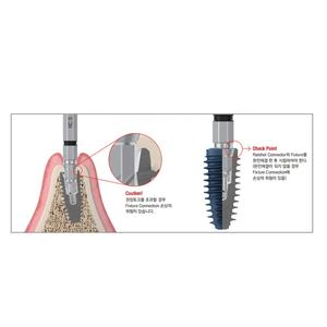 Blue Diamond Megagen System Tandheelkundig Chirurgisch Implantaat Kit Standaard Versie Originele Tandheelkundige Apparatuur Implantaatchirurgie - Product Image 5