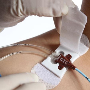 चिपकने वाला पैच स्थिरीकरण टेप पिकनिक cvc <span class=keywords><strong>iv</strong></span> जलसेक ट्यूब अलगाव स्टिकर कैथीटर निर्धारण ड्रेसिंग - Product Image 1