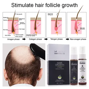 Produit à base de vitamines pour la croissance des cheveux, lotion, naturel, anti-chauve, pour croissance des cheveux, en 30 jours