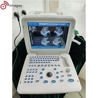Équipement portatif portatif de sonographie d'ultrason de Full Digital avec des options multiples de sonde pour la pratique générale