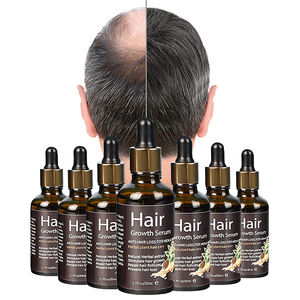 Óleo Sérum de Gengibre para Crescimento Capilar em 7 Dias Marca Própria para Pessoas Negras Tratamento do Couro Cabeludo Óleo de Alta Qualidade para Reparação do Folículo Piloso - Product Image 3