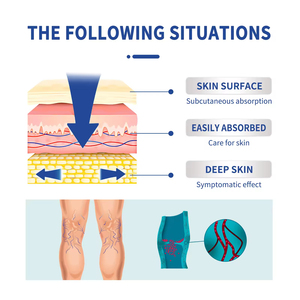 Nam trăng tĩnh mạch Massage Gel kem cho giãn tĩnh mạch chân giúp sửa chữa Giun đất chân và làm giảm chân mạch máu phình varicoidea - Product Image 5