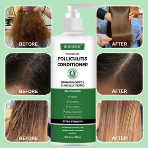 Shampoo et gel douche pour folliculite, tout neuf - Shampoo pour bébé contre les pellicules, aide à traiter la cradle cap et la dermatite séborrhéique, réduit les rougeurs - Product Image 5