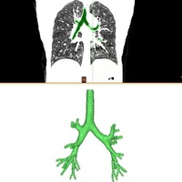 Modelo de Entrenamiento Bronquoscópico - Modelo de Fibrobroncoscopia Pulmonar Nivel 4 - Práctica de Fibroscopia en Nivel 4 Blanco Duro