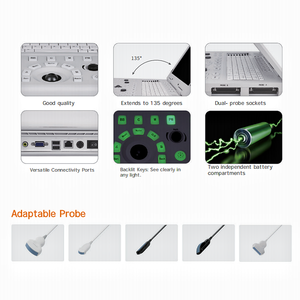 Diergeneeskundige echografiemachine met kleuren-doppler flow imaging voor varkens, koeien, honden en katten - Product Image 4