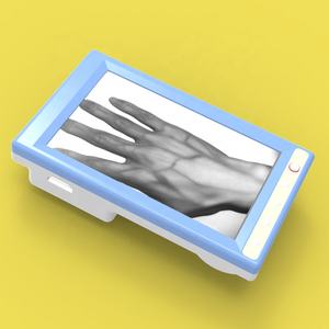 VF10 diskon besar-besaran 5 "penampil Nadi Portabel Tampilan LCD untuk injeksi anak dan dewasa - Product Image 1