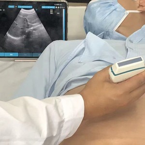 Chất lượng cao 128 yếu tố siêu âm DOPPLER màu siêu âm tuyến tính và lồi probe 2 trong 1 mslmy10 - Product Image 6