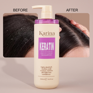 Produttore all'ingrosso OEM di <span class=keywords><strong>shampoo</strong></span> per capelli, <span class=keywords><strong>shampoo</strong></span> e balsamo <span class=keywords><strong>antiforfora</strong></span> alla cheratina a marchio privato per la riparazione dei capelli secchi - Product Image 3