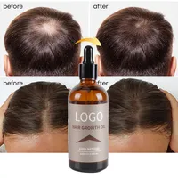 Средство против выпадения волос, Органическая Имбирная Сыворотка для роста волос, натуральное Фирменное масло для роста волос на травах