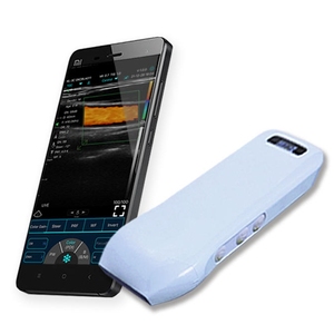 Konted مسبار الموجات فوق الصوتية المحمول Usb مسبار لاسلكي - Product Image 3