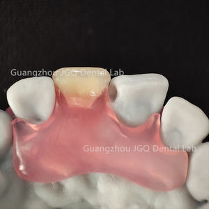 Lab odontoiatrico miglior prezzo prodotti personalizzati rimovibili protesi flessibili rosa <span class=keywords><strong>Valplast</strong></span> con Base Tcs denti acrilici buon Design - Product Image 5