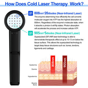 Dispositivo de Terapia Láser Frío Infrarrojo de Doble Longitud de Onda Sinergética de 808nm y 905nm para Fisioterapia Animal y Alivio del Dolor Humano - Product Image 2