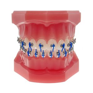 Supports orthodontiques auto-ligaturants brillants 2G avec crochet 345 pour vente en gros - Product Image 3