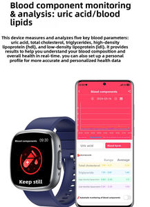 สมาร์ทวอทช์รุ่นใหม่ขายดีที่สุด ET593 พร้อมฟังก์ชันตรวจวัดคลื่นไฟฟ้าหัวใจ (ECG) และการเปลี่ยนแปลงของเลือด (PPG) ตรวจวัดกรดยูริกและไขมันในร่างกาย  ชาร์จผ่าน USB ตัวเรือนโลหะและซิลิกาเจล รองรับการโทร - Product Image 2