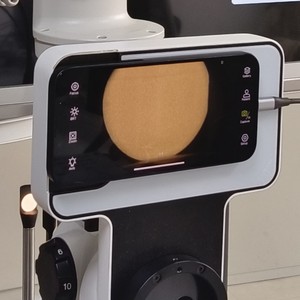 Sistema de Imagenología <span class=keywords><strong>para</strong></span> Lámpara de Hendidura de Alta Compatibilidad y Fácil Instalación, Compatible con iOS y Android <span class=keywords><strong>para</strong></span> Diagnóstico Oftalmológico - Product Image 6