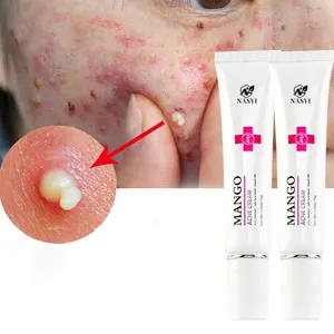 Fast Effective Face Care Anti Spots Mango Repair Removal Acne Cream Smooth Skin Shrink Pores Scar Blackhead Acne Treatment Cream