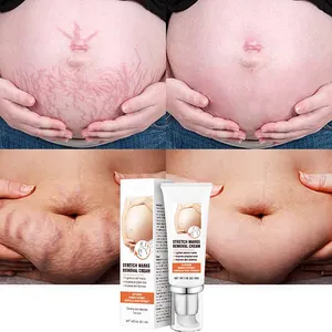 Vitamina c squalane marcas de gravidez, alta qualidade, reparo forte, remoção de cicatrizes de acne, creme removedor de marcas de estiramento