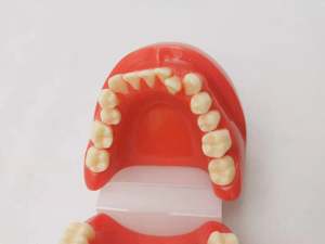 Model gigi ortodontik, kain Resin plastik, tampilan mispenyelaras gigi dengan ruang yang salah - Product Image 5