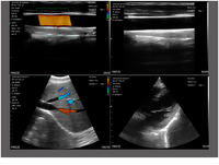 Escáner de Ultrasonido Doppler Color Inalámbrico 3 en 1, Equipo Hospitalario con Sonda Inalámbrica para Mascotas