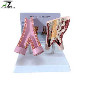 Modelo de Comparación de Vasos Sanguíneos Saludables y Vasos Sanguíneos Dañados por el Tabaco para la Enseñanza de Ciencias Médicas - Product Image 2