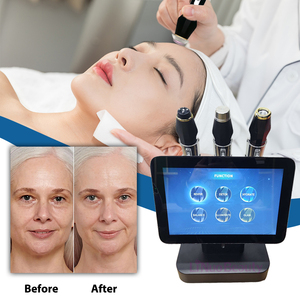 เครื่องผลัดเซลล์ผิว 3 in 1 Hydra Ultrasonic CO2 Oxygen Jet Peel พร้อมระบบสั่นสะเทือนและหมุนได้ สำหรับการฟื้นฟูผิวหน้า พร้อมปลั๊กแบบ US - Product Image 6