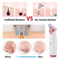 Machine d'élimination des boutons tête noire électrique pores nez aspirateur dissolvant de points noirs nettoyant outil de suppression avec aspiration sous vide