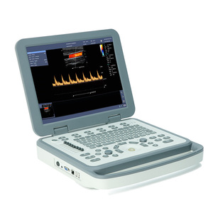 Kinh tế thú y thiết bị chẩn đoán màu đặc biệt máy tính xách tay B máy siêu âm cho động vật bệnh viện - Product Image 1