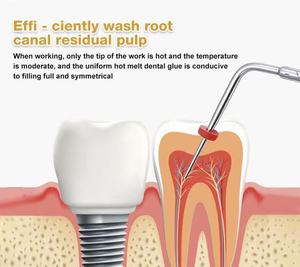 Penna Elettrica ad Alta Potenza per Otturazione Dentale, Attrezzatura per Riscaldamento di Punte in Guttaperca Endodontica, Realizzata in Metallo Resistente, Batterie Incluse - Product Image 6