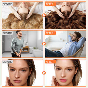 Atacado Vegan <span class=keywords><strong>Pumpkin</strong></span> <span class=keywords><strong>Seed</strong></span> <span class=keywords><strong>Oil</strong></span> <span class=keywords><strong>Softgel</strong></span> com Saw Palmetto Herbal Suplemento Cold Pressed <span class=keywords><strong>Pumpkin</strong></span> <span class=keywords><strong>Seed</strong></span> <span class=keywords><strong>Oil</strong></span> <span class=keywords><strong>Softgel</strong></span> 300 contagens - Product Image 4