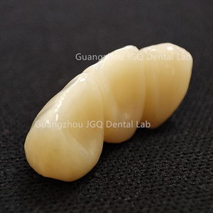 Couronnes en zircone solide avec <span class=keywords><strong>porcelaine</strong></span> Built-up Full Service China Dental Lab <span class=keywords><strong>Prix</strong></span> - Product Image 5