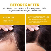 Fournisseurs de shampooing Ekber Shampooing réparateur à la biotine naturelle pour cheveux abîmés Stimulant la croissance des cheveux Après-shampoing Soin des cheveux