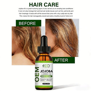OEM 100% Pure Jojoba Oil Pure <strong>Essential</strong> Oil Top Grade Cold Pressed <strong>Chemical</strong> Free for Moisturizing Hydrating All Skin 2fl oz - Product Image 4