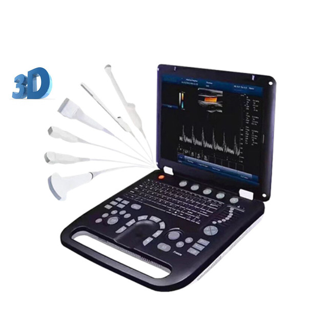Medical Ultrasound Instruments Ecografo Machine Digital Ultrasound Doppler Color Scanner