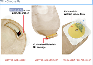 Bolsa <span class=keywords><strong>de</strong></span> Ostomía <span class=keywords><strong>de</strong></span> Dos Piezas Carbou Súper Práctica Suave Transpirable a Prueba <span class=keywords><strong>de</strong></span> Fugas Sin Derrames en Forma <span class=keywords><strong>de</strong></span> U 15-57mm para Colostomía - Product Image 6