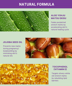 OEM/ODM cicatrice linea di riparazione crema 40g riparazione linee deboli levigatura rassodante Anti smagliature per le madri cura della pelle - Product Image 3