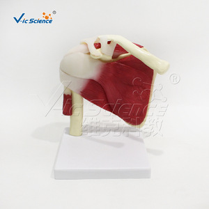 Modèle médical de l'articulation de l'épaule avec muscles et ligaments ; démonstration de l'atteinte de la coiffe des rotateurs ; enseignement et formation en réadaptation - Product Image 5