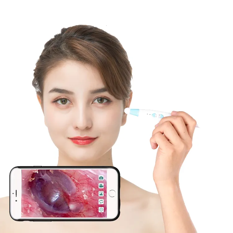 3 trục con quay hồi chuyển hình ảnh ráy tai làm sạch ráy tai loại bỏ 3 Megapixel 1080P Camera Wifi otoscope