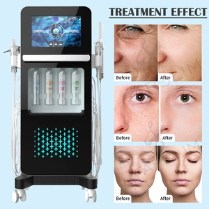17-Funktionen Hidrafacial Hydrodermabrasionsgerät Alice Aqua Peel Alice Super Bubble Hautpflegegerät für Kosmetikstudios - Product Image 3