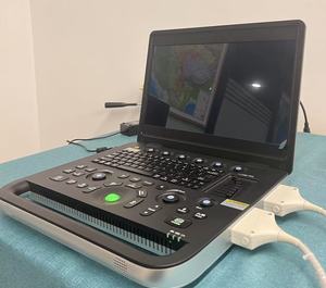 Ecógrafo Doppler Color Portátil Profesional 4D <span class=keywords><strong>5D</strong></span> con Pantalla de 15.6 Pulgadas, Sistema de Diagnóstico Cardíaco, Obstétrico y Ginecológico - Product Image 3